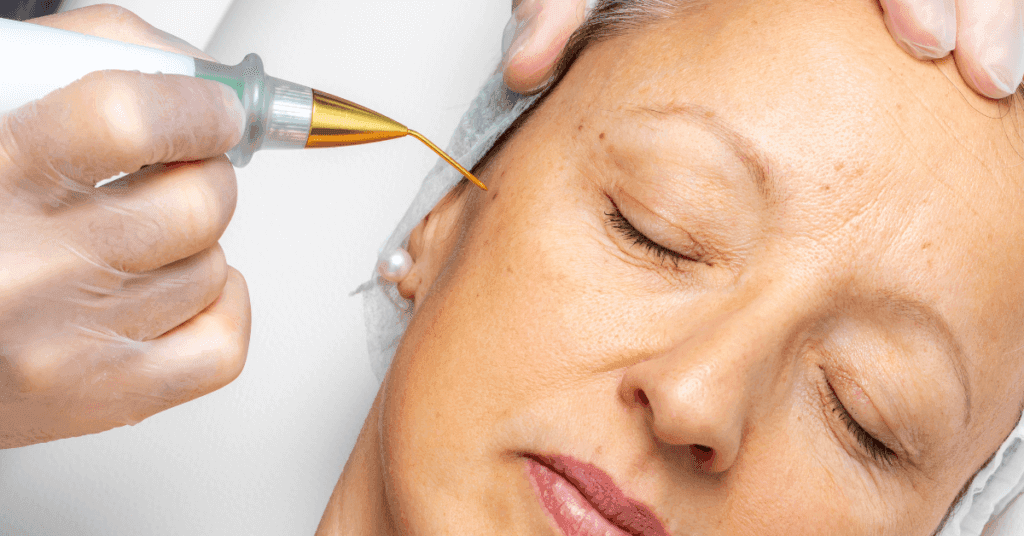 טיפול פנים פלזמה